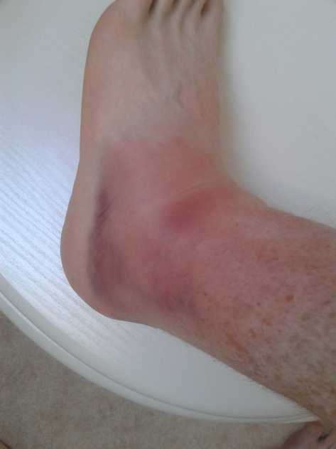 Waking up in the morning and being presented with this was not good